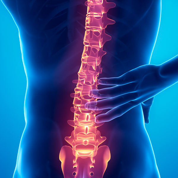 Spinal Cord Stimulation For Chronic Pain